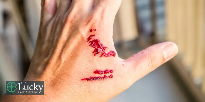 Expert Baton Rouge Dog Bite Attorney